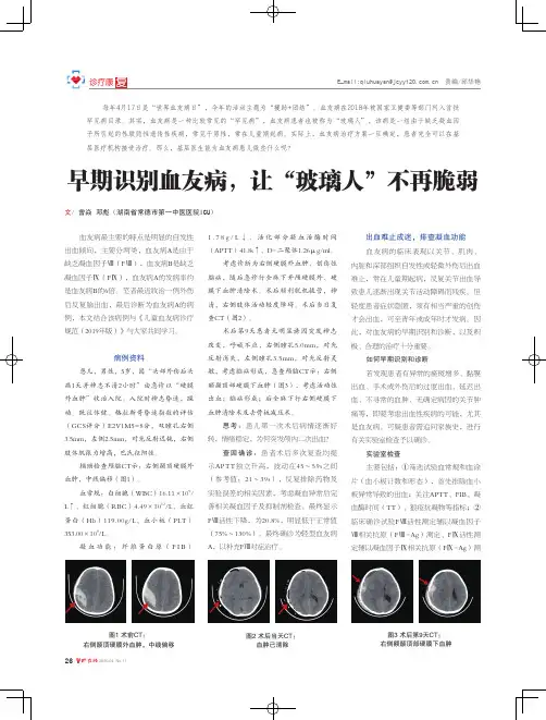 早期识别血友病,让“玻璃人”不再脆弱
