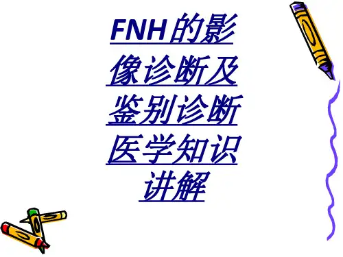 FNH的影像诊断及鉴别诊断医学知识讲解讲义