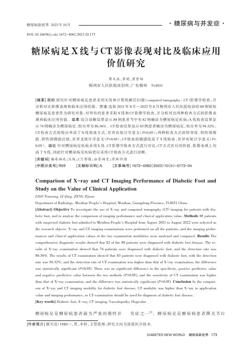 糖尿病足X_线与CT_影像表现对比及临床应用价值研究
