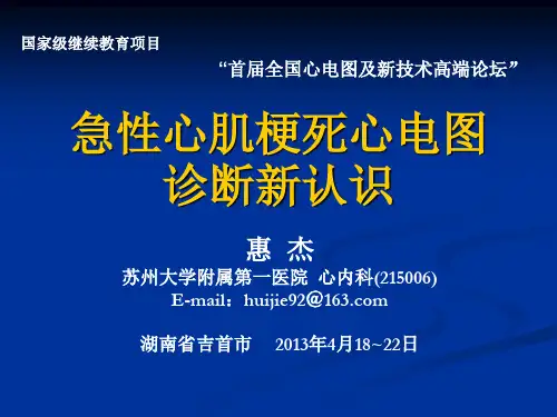 急性心肌梗死心电图诊断新认识-惠杰