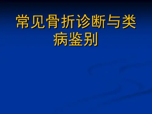 常见骨折的诊断与类病鉴别【125页】