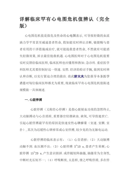 详解临床常见心电图危急值识别