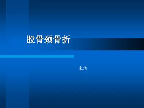 股骨颈骨折 ppt课件