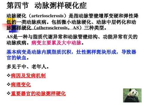 动脉粥样硬化