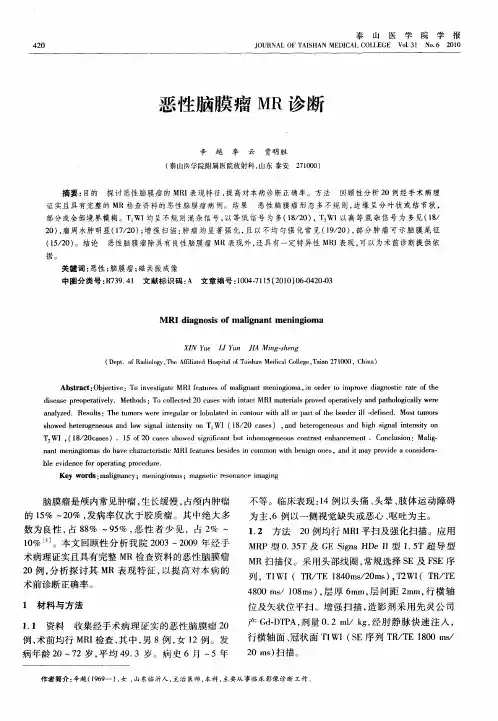 恶性脑膜瘤MR诊断