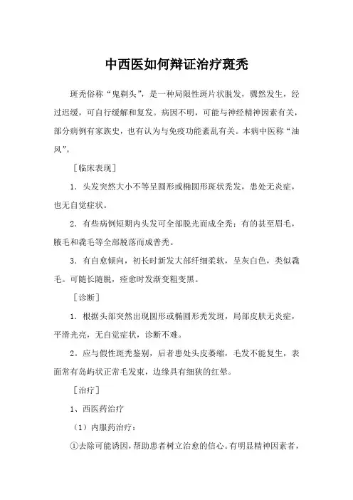 中西医如何辩证治疗斑秃