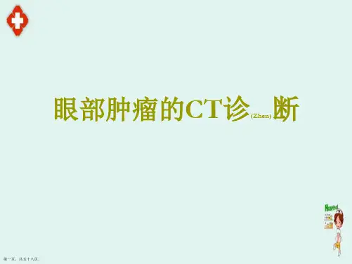 眼部肿瘤的CT治疗及诊断深入培训ppt
