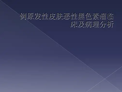 例原发性皮肤恶性黑色素瘤临床及病理分析