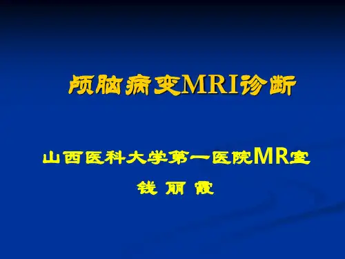 颅脑病变MRI诊断-血管变性病