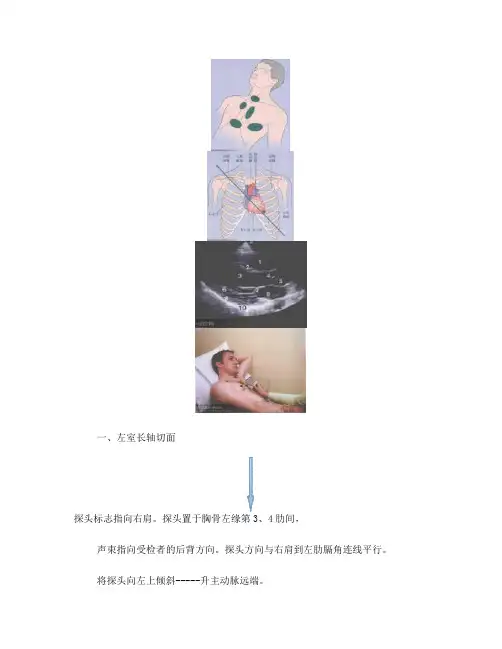 最简略超声心动图的各个切面打法