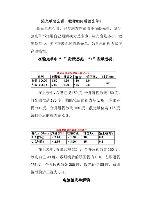 验光单怎么看