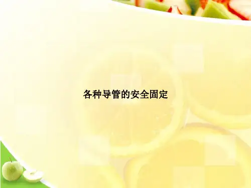 各种导管的安全固定演示文档