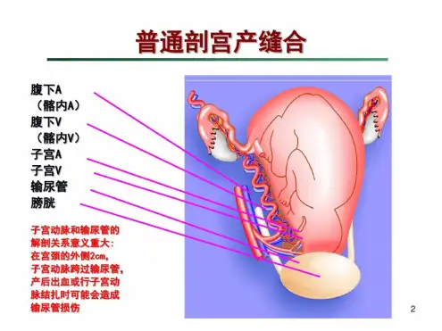 剖宫产手术缝合技术课堂课件
