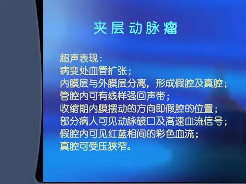 外周血管疾病的超声诊断