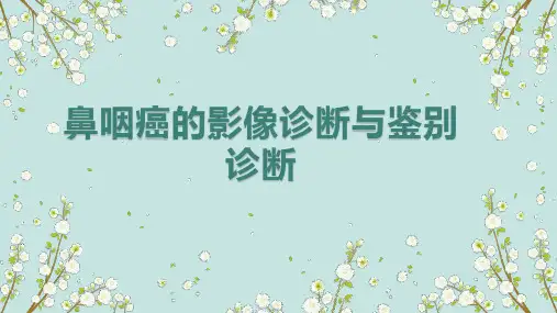 鼻咽癌的影像诊断与鉴别诊断