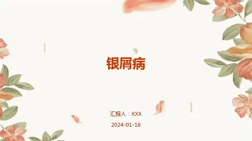 银屑病疾病PPT演示课件