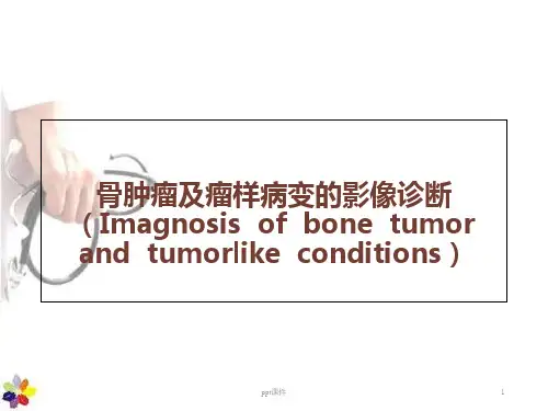 骨肿瘤及瘤样病变的影像诊断  ppt课件