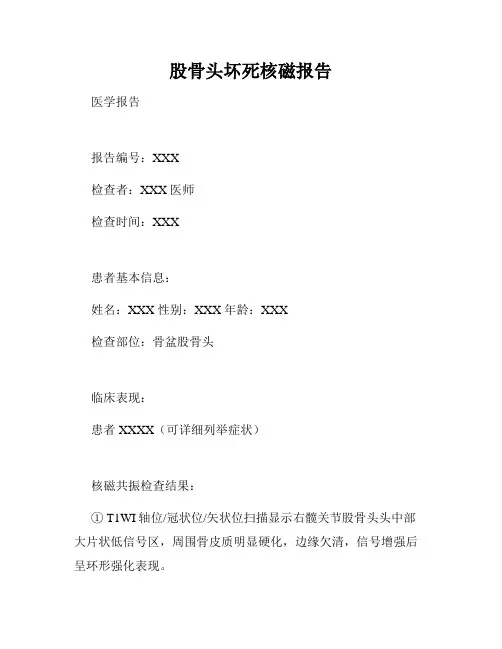 股骨头坏死核磁报告