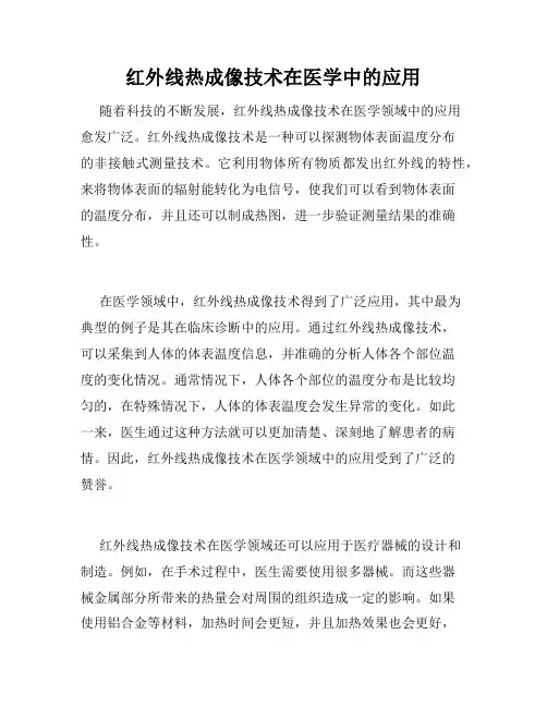 红外线热成像技术在医学中的应用