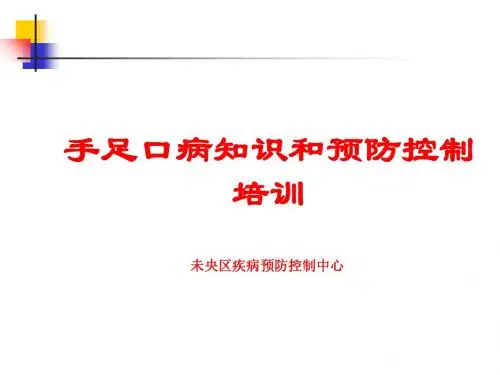 手足口病知识和预防控制培训(PPT29张)