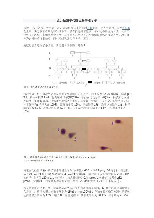 近亲结婚子代圆头精子症1例