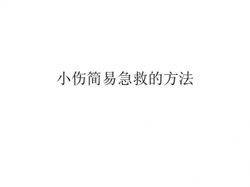 小伤简易急救的方ppt课件.ppt