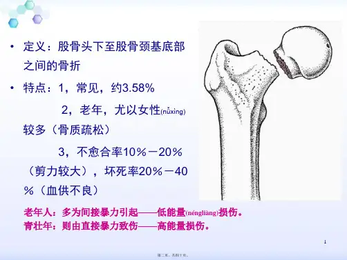 医学专题股骨颈骨折骨一科