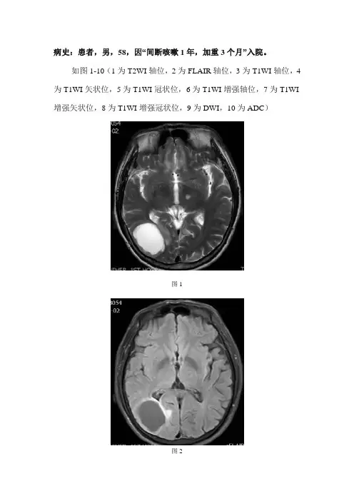 颅内多发环形强化囊性占位病变MRI影像诊断及鉴别诊断--转移瘤