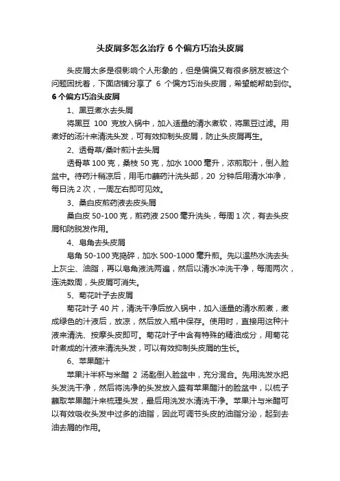 头皮屑多怎么治疗6个偏方巧治头皮屑