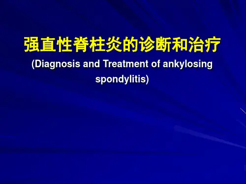 强直性脊柱炎的诊断和治疗PPT课件