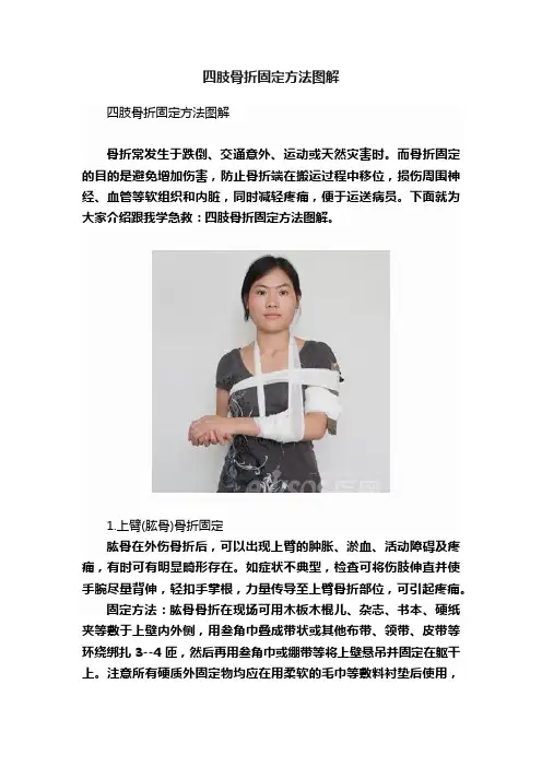 四肢骨折固定方法图解