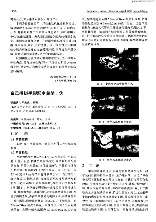 自己捆绑手脚溺水自杀1例