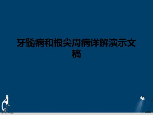 牙髓病和根尖周病详解演示文稿