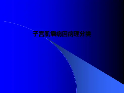 子宫肌瘤病因病理分类PPT课件