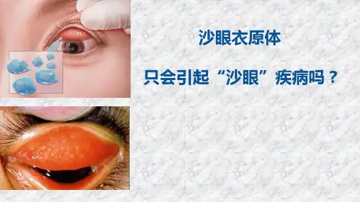 生殖道沙眼衣原体实验室检测课件
