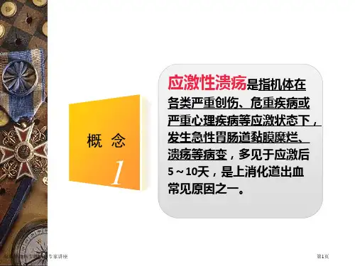 应激性溃疡专题知识专家讲座
