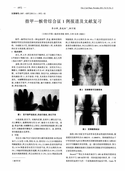 指甲—髌骨综合征1例报道及文献复习