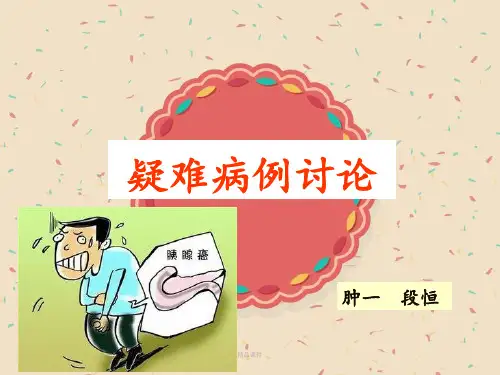 胰腺癌病例讨论