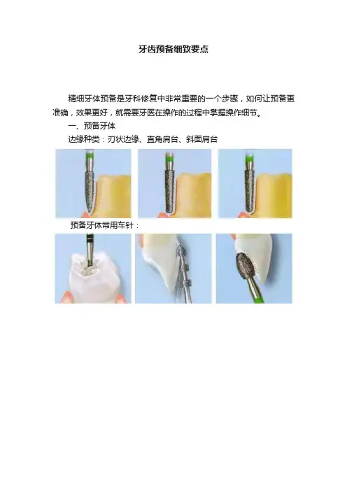 牙齿预备细致要点