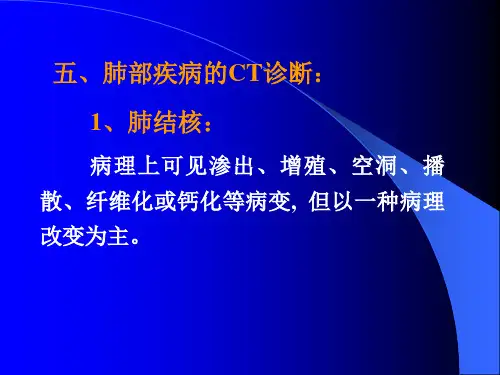 胸部疾病CT诊断学课件