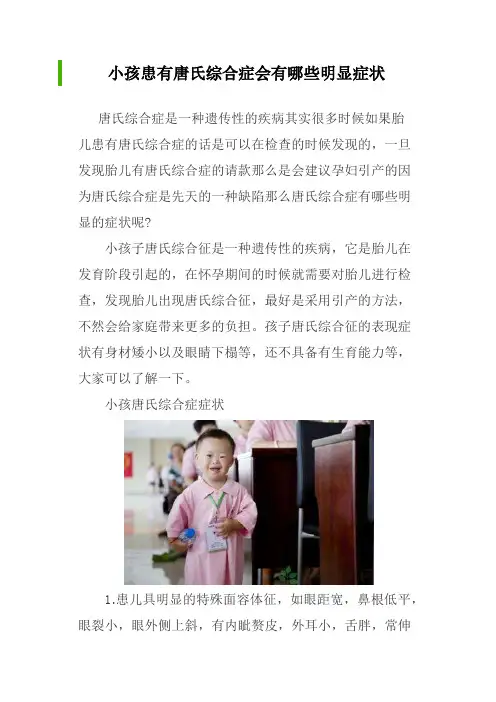 小孩患有唐氏综合症会有哪些明显症状