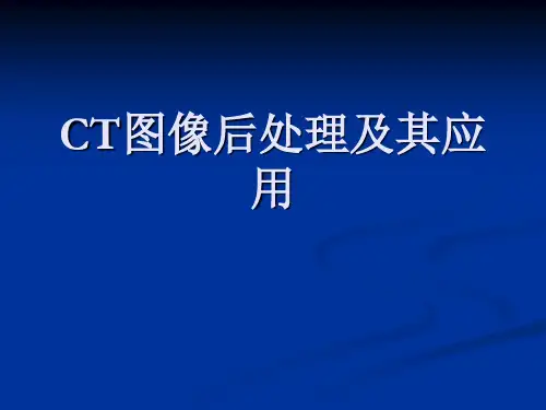 CT图像后处理及其应用(88页)