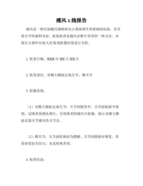 痛风x线报告
