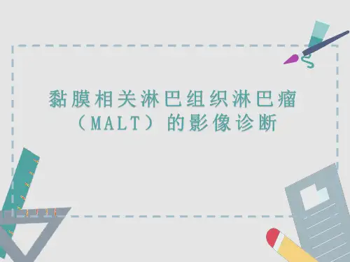 黏膜相关淋巴组织淋巴瘤(MALT)的影像诊断