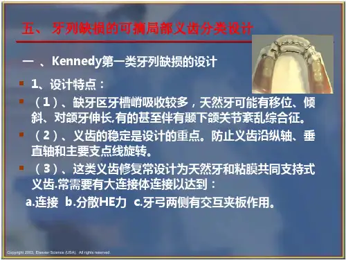 可摘局部义齿的分类设计