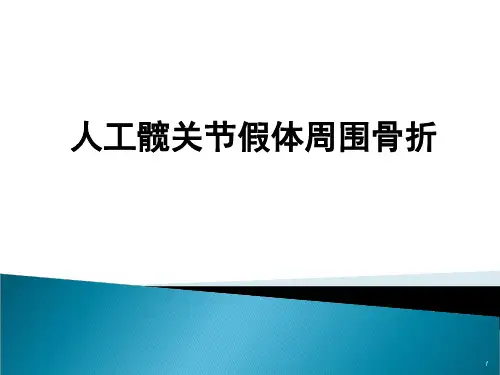 人工髋关节假体周围骨折ppt课件