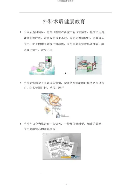 ICU健康教育患者