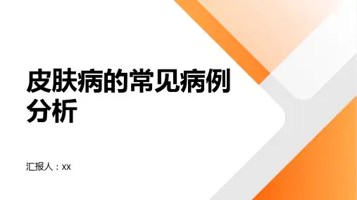皮肤病的常见病例分析