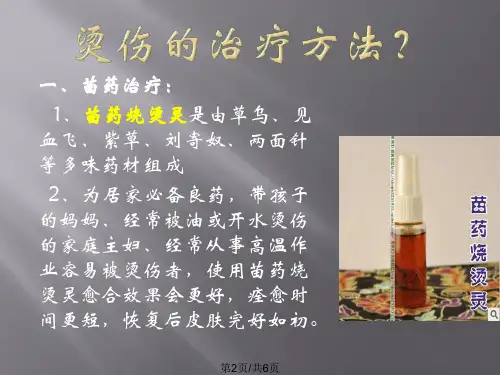 烫伤用什么药