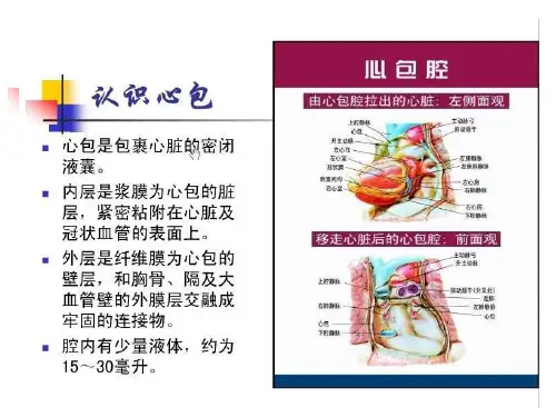 最新心包压塞时外科干预时机的选择PPT课件